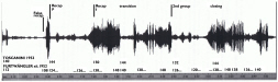 Figure 18: Wilhelm
                    Furtwängler and Arturo Toscanini, Beethoven 3rd Symphony, 1st movement,
                    recapitulation: tempi